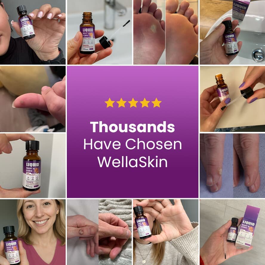 WellaSkin image